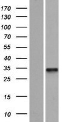 Western Blot: C19orf66 Overexpression Lysate (Adult Normal) [NBP2-06808] Left-Empty vector transfected control cell lysate (HEK293 cell lysate); Right -Over-expression Lysate for C19orf66.