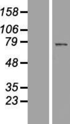 Western Blot: SPATA7 Overexpression Lysate (Adult Normal) [NBP2-06801] Left-Empty vector transfected control cell lysate (HEK293 cell lysate); Right -Over-expression Lysate for SPATA7.