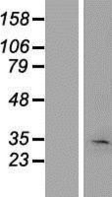 Western Blot: KRT222 Overexpression Lysate (Adult Normal) [NBP2-05390] Left-Empty vector transfected control cell lysate (HEK293 cell lysate); Right -Over-expression Lysate for KRT222.