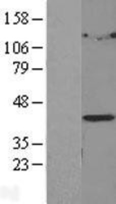 Western Blot: LPGAT1 Overexpression Lysate (Adult Normal) [NBL1-12652] Left-Empty vector transfected control cell lysate (HEK293 cell lysate); Right -Over-expression Lysate for LPGAT1.