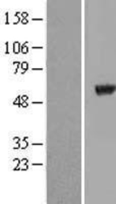 Western Blot: Tubulin alpha-8 Overexpression Lysate (Adult Normal) [NBL1-17434] Left-Empty vector transfected control cell lysate (HEK293 cell lysate); Right -Over-expression Lysate for Tubulin alpha-8.