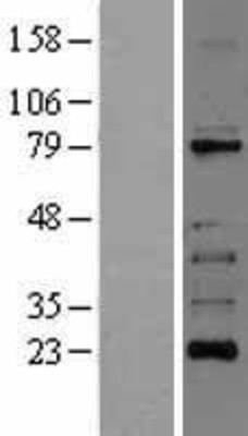 Western Blot: RIPK1 Overexpression Lysate (Adult Normal) [NBL1-15377] Left-Empty vector transfected control cell lysate (HEK293 cell lysate); Right -Over-expression Lysate for RIPK1.