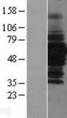 Western Blot: HDAC1 Overexpression Lysate (Adult Normal) [NBL1-11477] Left-Empty vector transfected control cell lysate (HEK293 cell lysate); Right -Over-expression Lysate for HDAC1.