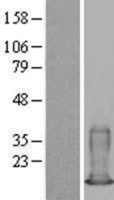 Western Blot: S100A6 Overexpression Lysate (Adult Normal) [NBL1-15658] Left-Empty vector transfected control cell lysate (HEK293 cell lysate); Right -Over-expression Lysate for S100A6.
