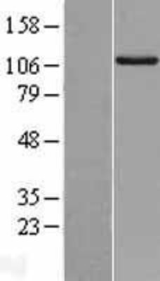 Western Blot: RIPK5 Overexpression Lysate (Adult Normal) [NBL1-15380] Left-Empty vector transfected control cell lysate (HEK293 cell lysate); Right -Over-expression Lysate for RIPK5.