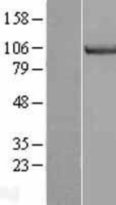Western Blot: MCM3 Overexpression Lysate (Adult Normal) [NBL1-12951] Left-Empty vector transfected control cell lysate (HEK293 cell lysate); Right -Over-expression Lysate for MCM3.