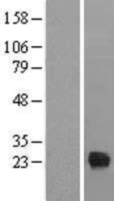 Western Blot: TIFA Overexpression Lysate (Adult Normal) [NBL1-16910] Left-Empty vector transfected control cell lysate (HEK293 cell lysate); Right -Over-expression Lysate for TIFA.