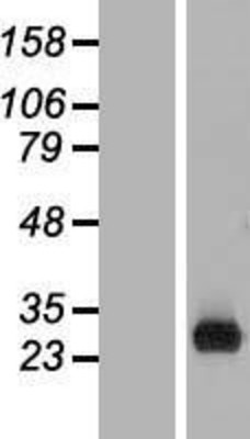 Western Blot: C1orf186 Overexpression Lysate (Adult Normal) [NBL1-08307] Left-Empty vector transfected control cell lysate (HEK293 cell lysate); Right -Over-expression Lysate for C1orf186.