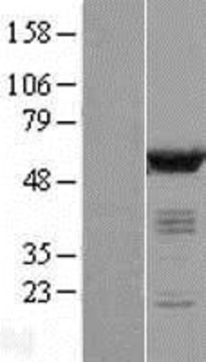 Western Blot: CaMKII delta Overexpression Lysate (Adult Normal) [NBL1-08664] Left-Empty vector transfected control cell lysate (HEK293 cell lysate); Right -Over-expression Lysate for CaMKII delta.