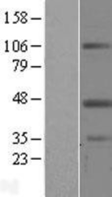 Western Blot: Leupaxin Overexpression Lysate (Adult Normal) [NBL1-12658] Left-Empty vector transfected control cell lysate (HEK293 cell lysate); Right -Over-expression Lysate for Leupaxin.