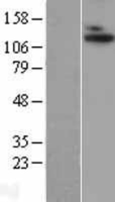 Western Blot: ADAMTS10 Overexpression Lysate (Adult Normal) [NBL1-07315] Left-Empty vector transfected control cell lysate (HEK293 cell lysate); Right -Over-expression Lysate for ADAMTS10.