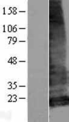 Western Blot: LHFPL5 Overexpression Lysate (Adult Normal) [NBP2-04852] Left-Empty vector transfected control cell lysate (HEK293 cell lysate); Right -Over-expression Lysate for LHFPL5.