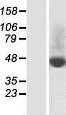 Western Blot: SLC37A2 Overexpression Lysate (Adult Normal) [NBP2-04718] Left-Empty vector transfected control cell lysate (HEK293 cell lysate); Right -Over-expression Lysate for SLC37A2.