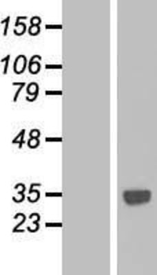 Western Blot: CTDSPL Overexpression Lysate (Adult Normal) [NBP2-08808] Left-Empty vector transfected control cell lysate (HEK293 cell lysate); Right -Over-expression Lysate for CTDSPL.