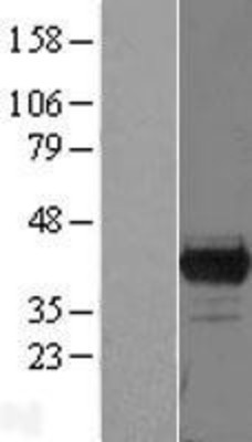 Western Blot: PBK Overexpression Lysate (Adult Normal) [NBL1-14135] Left-Empty vector transfected control cell lysate (HEK293 cell lysate); Right -Over-expression Lysate for PBK.