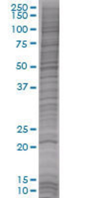 ARL6IP transfected lysate