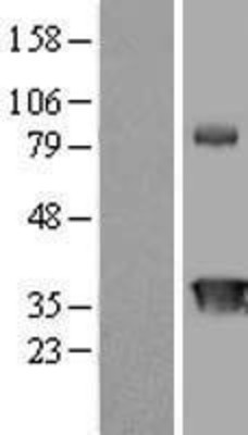 Western Blot: CIAPIN1 Overexpression Lysate (Adult Normal) [NBL1-09203] Left-Empty vector transfected control cell lysate (HEK293 cell lysate); Right -Over-expression Lysate for CIAPIN1.