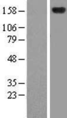 Western Blot: ZFYVE9 Overexpression Lysate (Adult Normal) [NBL1-18029] Left-Empty vector transfected control cell lysate (HEK293 cell lysate); Right -Over-expression Lysate for ZFYVE9.
