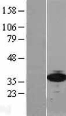 Western Blot: 67kDa Laminin Receptor Overexpression Lysate (Adult Normal) [NBL1-15578] Left-Empty vector transfected control cell lysate (HEK293 cell lysate); Right -Over-expression Lysate for 67kDa Laminin Receptor.