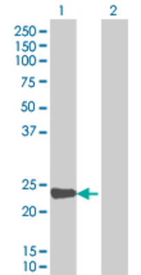 Lane 1: ARL6IP transfected lysate (22.44 KDa). Lane 2: Non-transfected lysate.