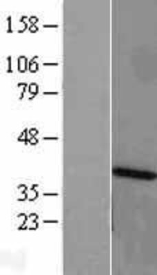 Western Blot: ANKRD1 Overexpression Lysate (Adult Normal) [NBL1-07533] Left-Empty vector transfected control cell lysate (HEK293 cell lysate); Right -Over-expression Lysate for ANKRD1.