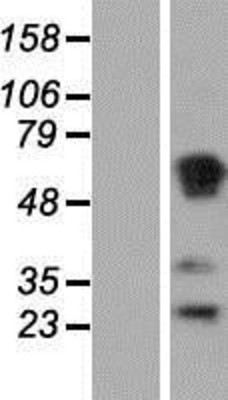 Western Blot: RASSF1 Overexpression Lysate (Adult Normal) [NBP2-05213] Left-Empty vector transfected control cell lysate (HEK293 cell lysate); Right -Over-expression Lysate for RASSF1.