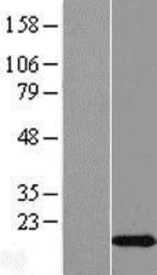 Western Blot: C2orf76 Overexpression Lysate (Adult Normal) [NBL1-12575] Left-Empty vector transfected control cell lysate (HEK293 cell lysate); Right -Over-expression Lysate for C2orf76.