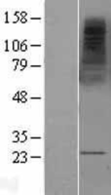 Western Blot: MS4A2 Overexpression Lysate (Adult Normal) [NBL1-13315] Left-Empty vector transfected control cell lysate (HEK293 cell lysate); Right -Over-expression Lysate for MS4A2.