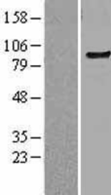 Western Blot: TLR6 Overexpression Lysate (Adult Normal) [NBL1-16955] Left-Empty vector transfected control cell lysate (HEK293 cell lysate); Right -Over-expression Lysate for TLR6.