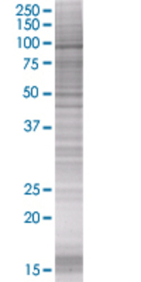RHOBTB2 transfected lysate