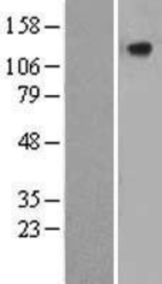 Western Blot: CILP Overexpression Lysate (Adult Normal) [NBL1-09208] Left-Empty vector transfected control cell lysate (HEK293 cell lysate); Right -Over-expression Lysate for CILP.