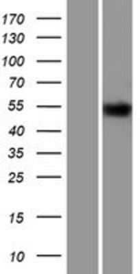 Western Blot: Thyroid Hormone Receptor alpha Overexpression Lysate (Adult Normal) [NBL1-16895] Left-Empty vector transfected control cell lysate (HEK293 cell lysate); Right -Over-expression Lysate for Thyroid Hormone Receptor alpha.