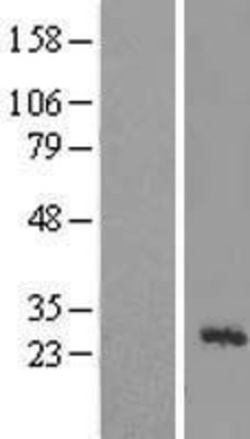 Western Blot: MRPL43 Overexpression Lysate (Adult Normal) [NBL1-13270] Left-Empty vector transfected control cell lysate (HEK293 cell lysate); Right -Over-expression Lysate for MRPL43.