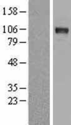 Western Blot: DDR2 Overexpression Lysate (Adult Normal) [NBP2-09152] Left-Empty vector transfected control cell lysate (HEK293 cell lysate); Right -Over-expression Lysate for DDR2.