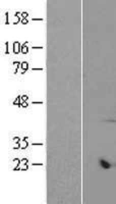 Western Blot: ARMCX6 Overexpression Lysate (Adult Normal) [NBP2-09129] Left-Empty vector transfected control cell lysate (HEK293 cell lysate); Right -Over-expression Lysate for ARMCX6.