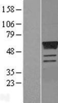 Western Blot: Estrogen Related Receptor gamma Overexpression Lysate (Adult Normal) [NBL1-10347] Left-Empty vector transfected control cell lysate (HEK293 cell lysate); Right -Over-expression Lysate for Estrogen Related Receptor gamma.