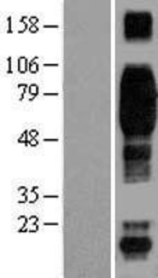 Western Blot: CD244 Overexpression Lysate (Adult Normal) [NBL1-08924] Left-Empty vector transfected control cell lysate (HEK293 cell lysate); Right -Over-expression Lysate for CD244.
