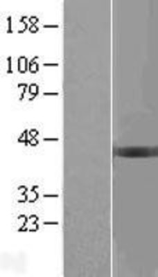 Western Blot: BCKDHB Overexpression Lysate (Adult Normal) [NBL1-07944] Left-Empty vector transfected control cell lysate (HEK293 cell lysate); Right -Over-expression Lysate for BCKDHB.