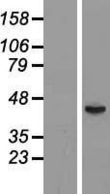 Western Blot: FUT6 Overexpression Lysate (Adult Normal) [NBP2-09224] Left-Empty vector transfected control cell lysate (HEK293 cell lysate); Right -Over-expression Lysate for FUT6.