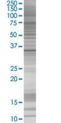 TYMS transfected lysate.