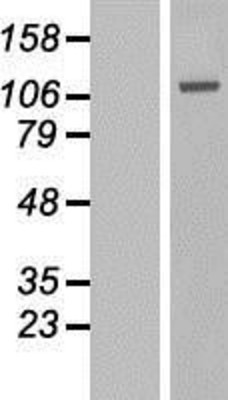 Western Blot: GAA Overexpression Lysate (Adult Normal) [NBL1-10902] Left-Empty vector transfected control cell lysate (HEK293 cell lysate); Right -Over-expression Lysate for GAA.