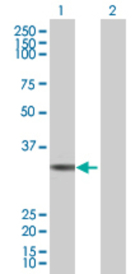 Lane 1: TYMS transfected lysate (35.7 KDa) Lane 2: Non-transfected lysate.