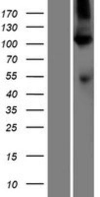 Western Blot: SERCA1 ATPase Overexpression Lysate (Adult Normal) [NBP2-05144] Left-Empty vector transfected control cell lysate (HEK293 cell lysate); Right -Over-expression Lysate for SERCA1 ATPase.