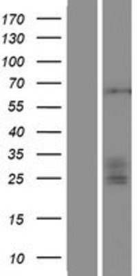 Western Blot: ST3GAL4 Overexpression Lysate (Adult Normal) [NBP2-07648] Left-Empty vector transfected control cell lysate (HEK293 cell lysate); Right -Over-expression Lysate for ST3GAL4.
