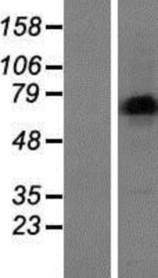 Western Blot: LIMD1 Overexpression Lysate (Adult Normal) [NBP2-07368] Left-Empty vector transfected control cell lysate (HEK293 cell lysate); Right -Over-expression Lysate for LIMD1.