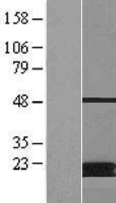 Western Blot: MCAT Overexpression Lysate (Adult Normal) [NBP2-07319] Left-Empty vector transfected control cell lysate (HEK293 cell lysate); Right -Over-expression Lysate for MCAT.
