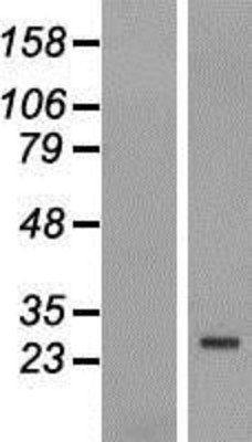 Western Blot: FBXO25 Overexpression Lysate (Adult Normal) [NBP2-07486] Left-Empty vector transfected control cell lysate (HEK293 cell lysate); Right -Over-expression Lysate for FBXO25.