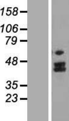 Western Blot: MTERFD2 Overexpression Lysate (Adult Normal) [NBL1-13358] Left-Empty vector transfected control cell lysate (HEK293 cell lysate); Right -Over-expression Lysate for MTERFD2.