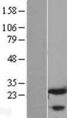 Western Blot: FKBP25 Overexpression Lysate (Adult Normal) [NBL1-10737] Left-Empty vector transfected control cell lysate (HEK293 cell lysate); Right -Over-expression Lysate for FKBP25.