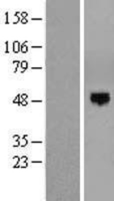 Western Blot: AER61 Overexpression Lysate (Adult Normal) [NBP2-05128] Left-Empty vector transfected control cell lysate (HEK293 cell lysate); Right -Over-expression Lysate for AER61.